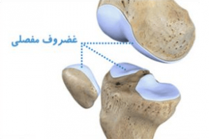 غضروف مفصلی